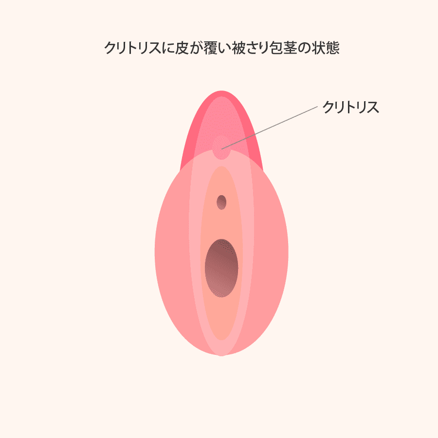 解説イラスト