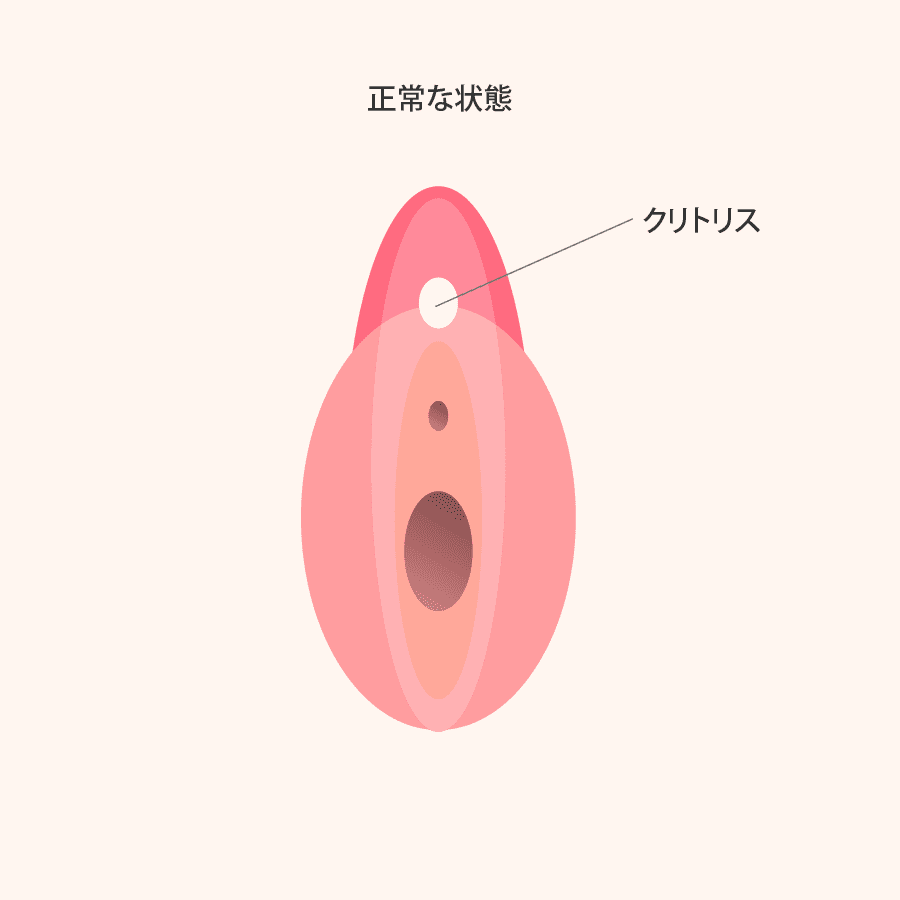 解説イラスト