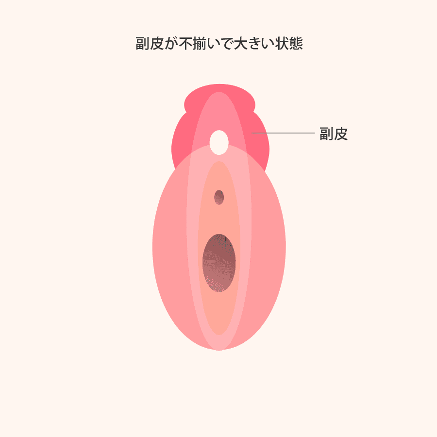 解説イラスト