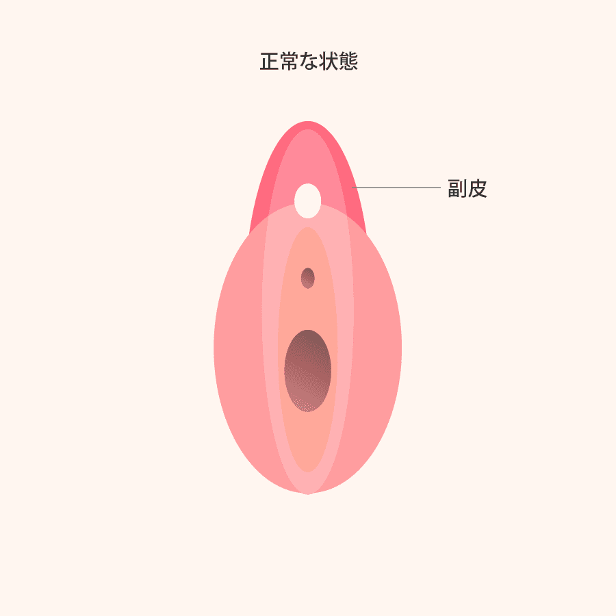 解説イラスト