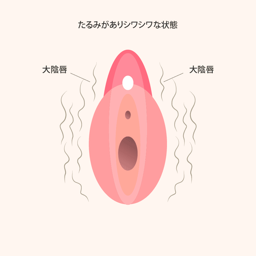 解説イラスト