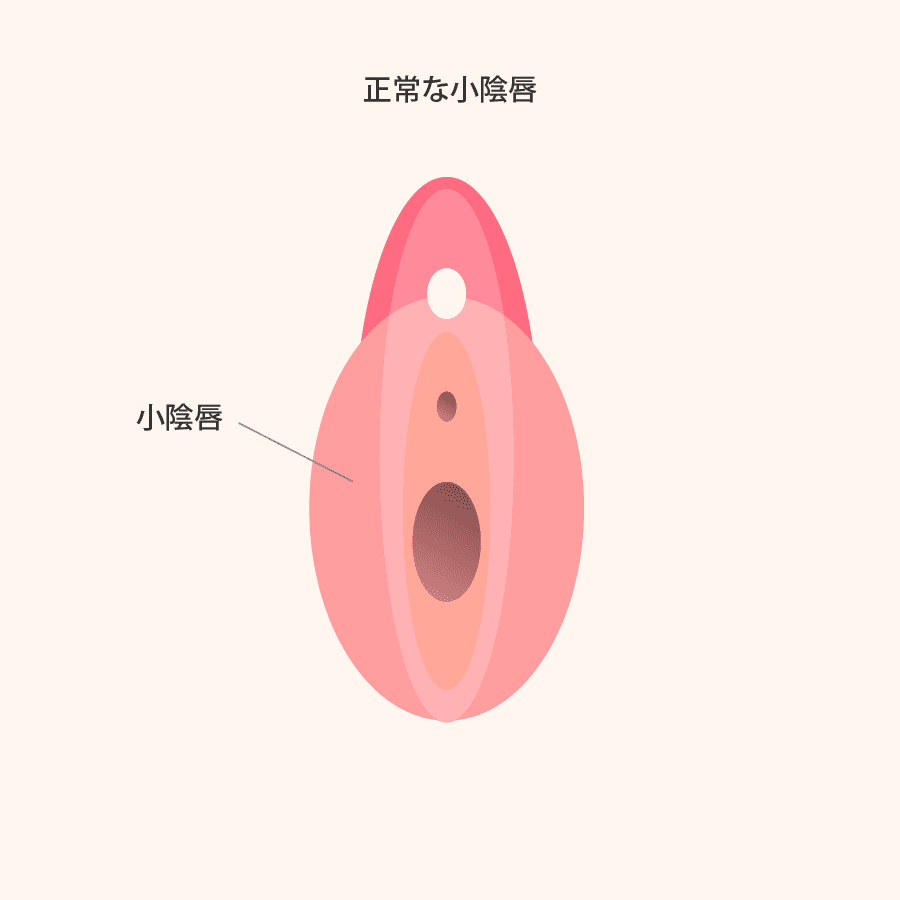 解説イラスト