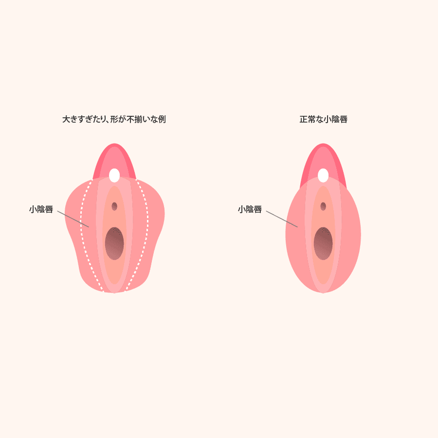 術式のイラスト画像