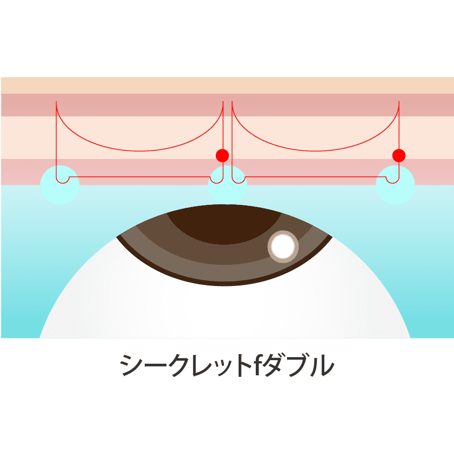 解説イラスト