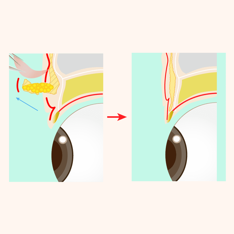 術式のイラスト画像