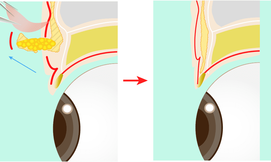 解説イラスト