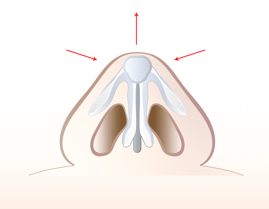 解説イラスト