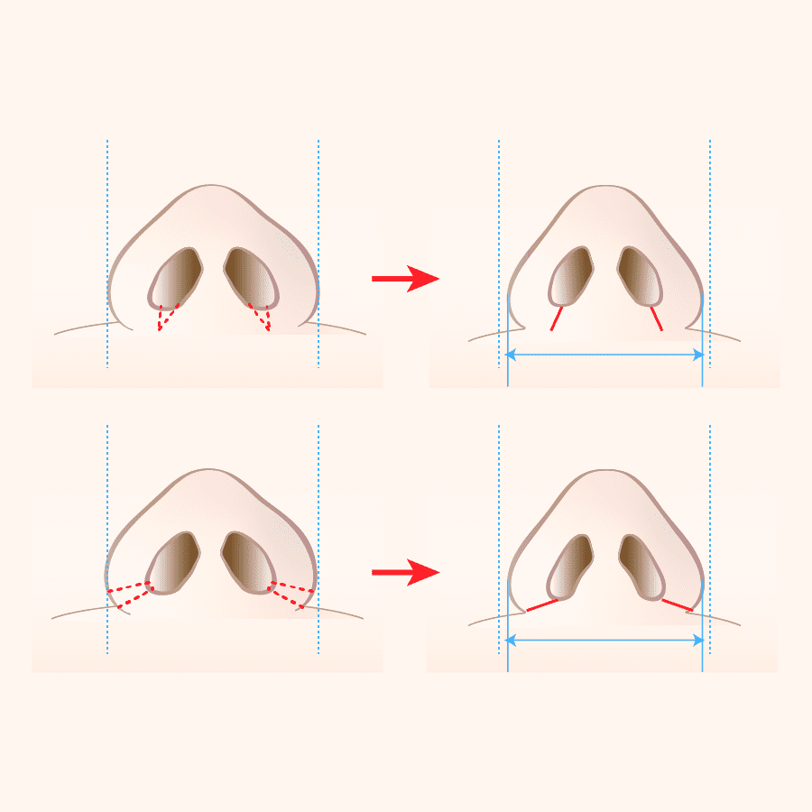 術式のイラスト画像