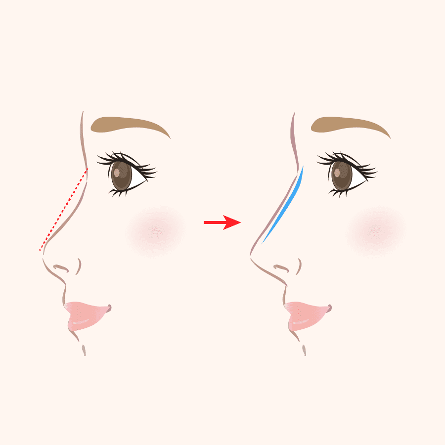 術式のイラスト画像