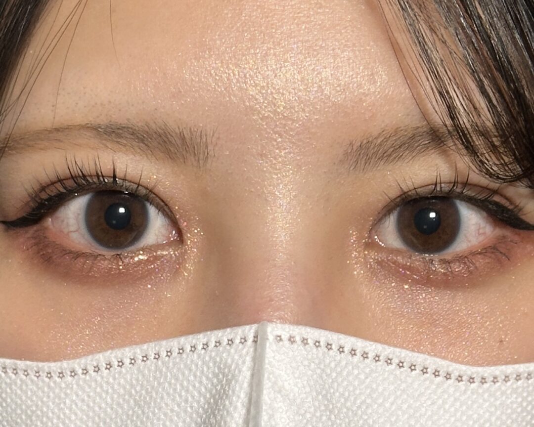 術後
