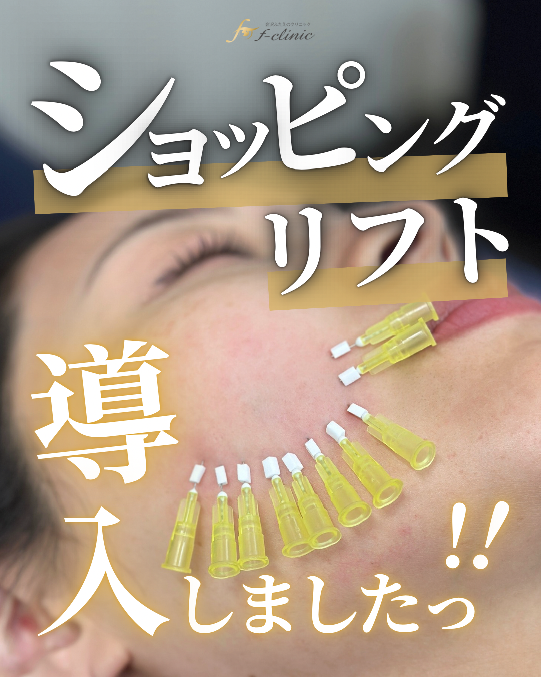 ショッピングリフト