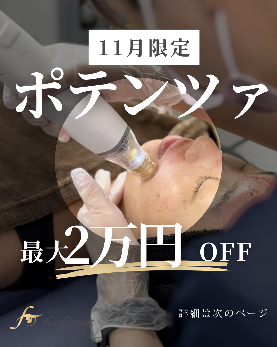 ポテンツァ11月キャンペーン