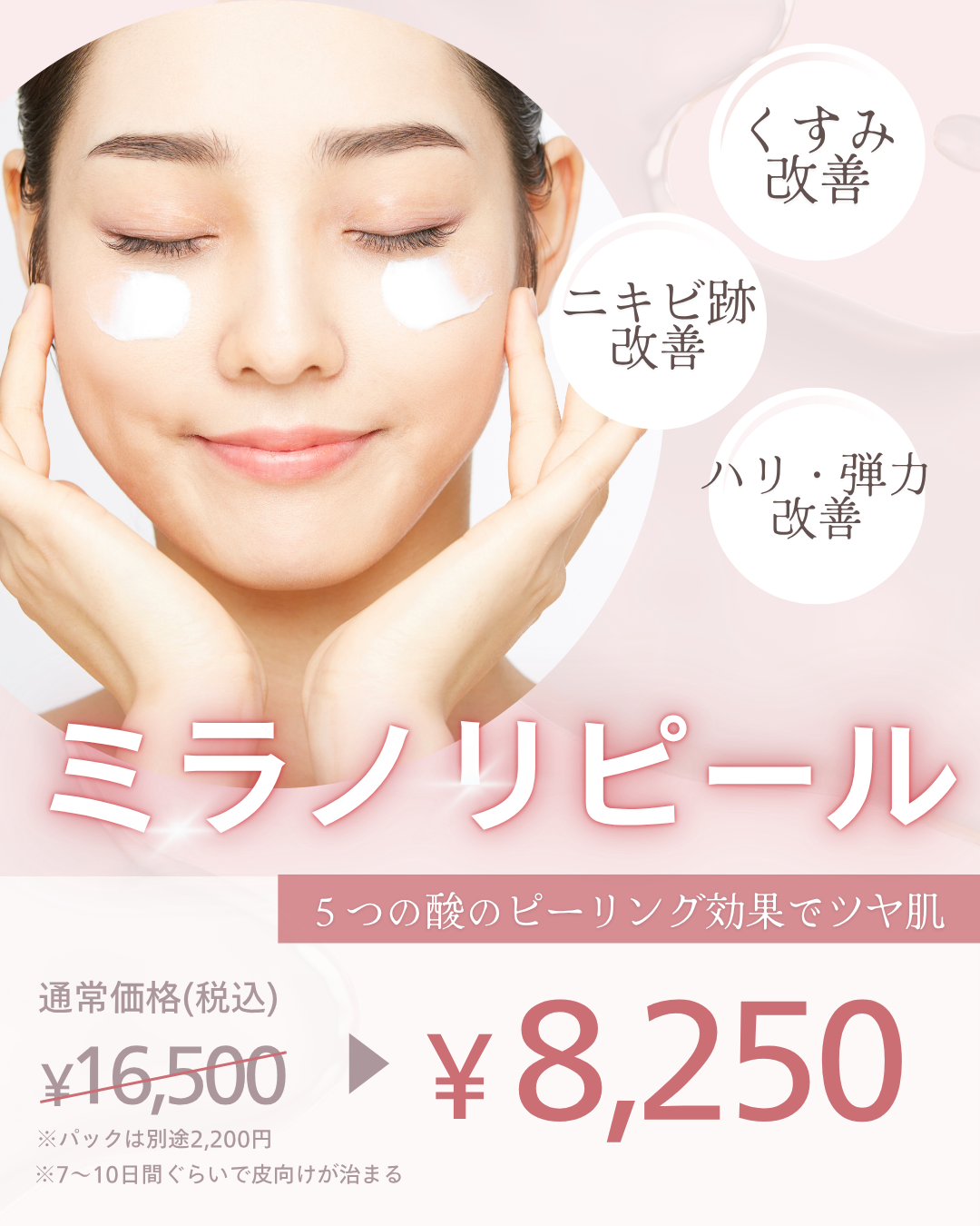ミラノリピール
