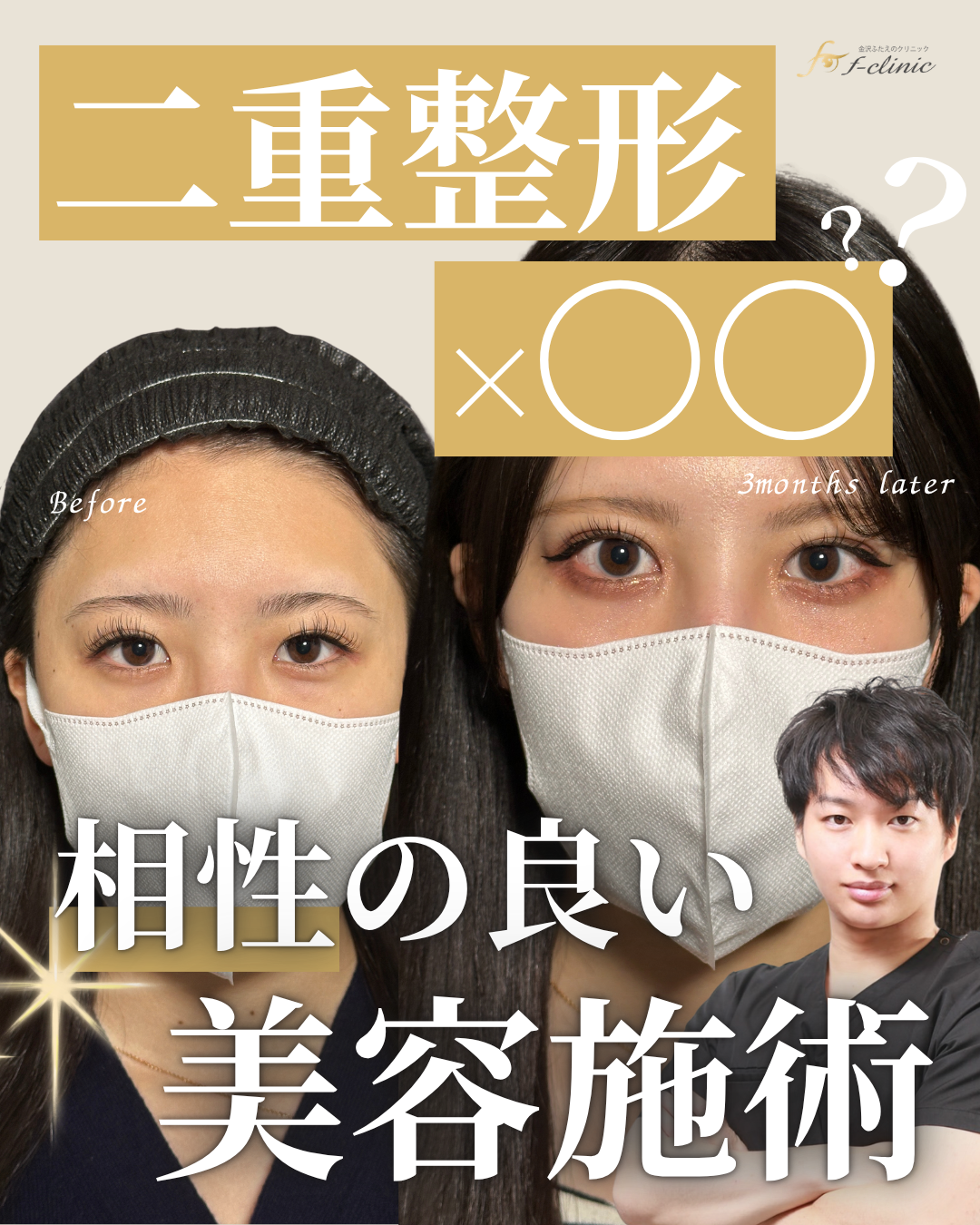 二重整形×◯◯