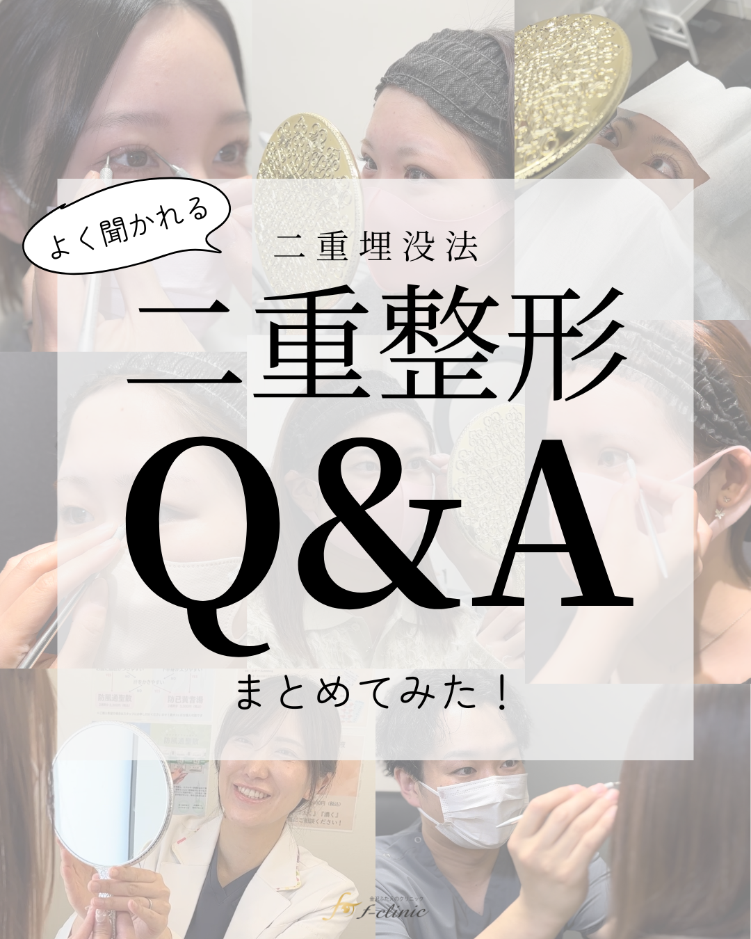 二重整形Q&A