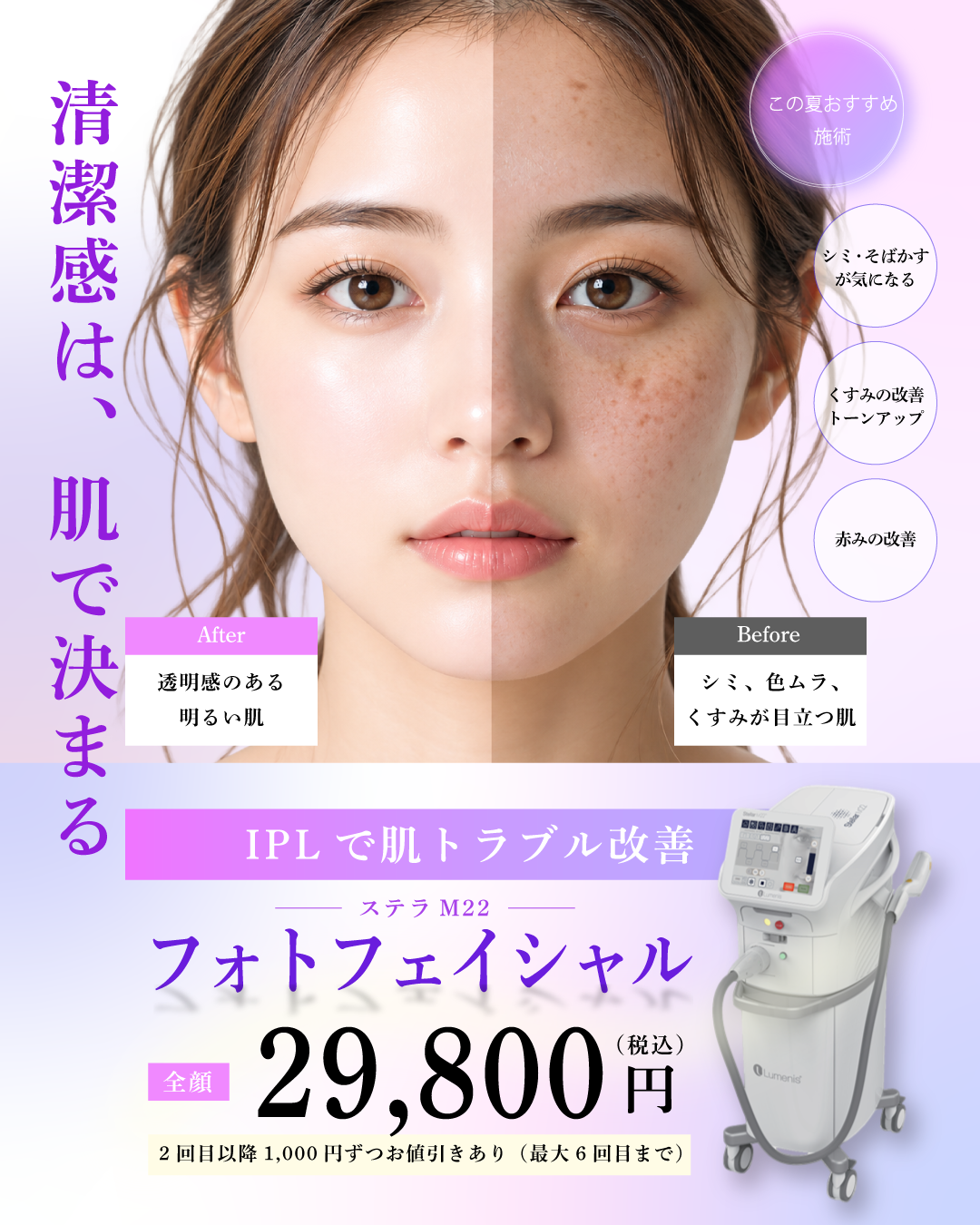 フォトフェイシャル